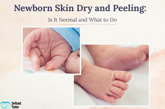 Newborn Skin Dry and Peeling